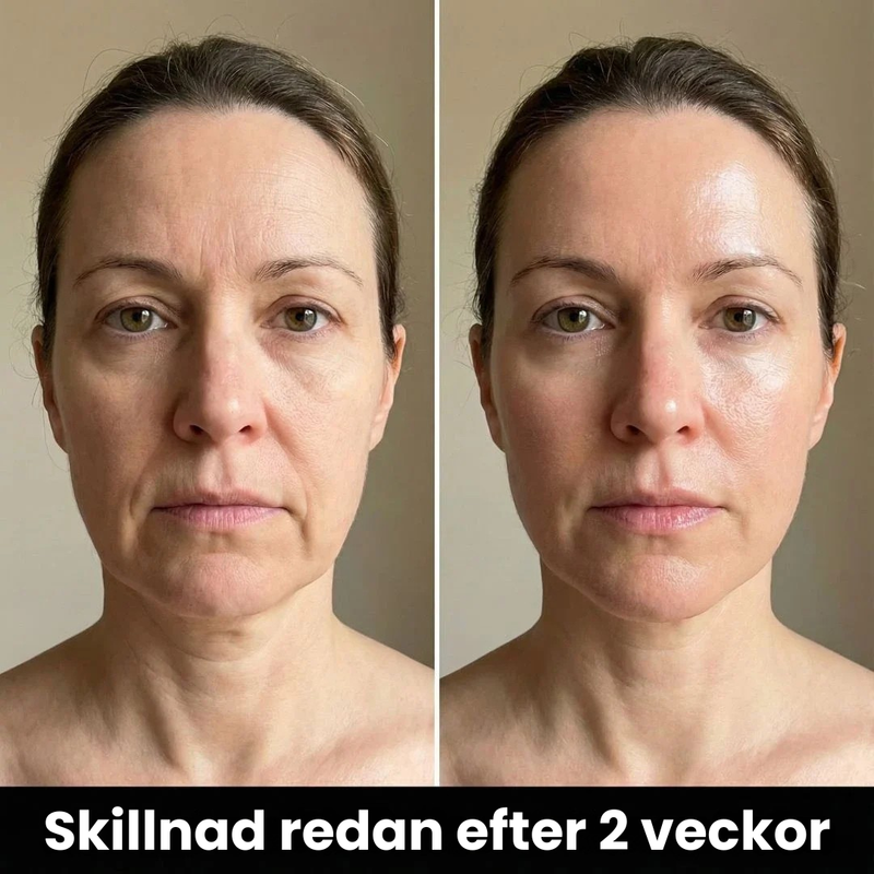 Varför Din Hud Plötsligt Ser 10 År Äldre Ut — Och Vad Du Kan Göra Åt Det Nu"