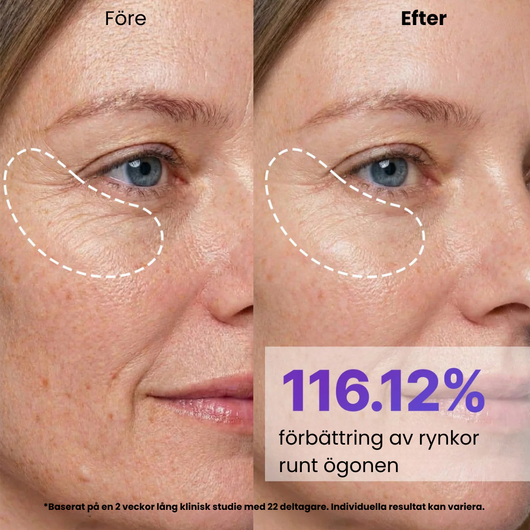Silk Peptide Gold Mask