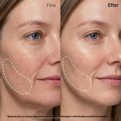 Silk Peptide Gold Mask