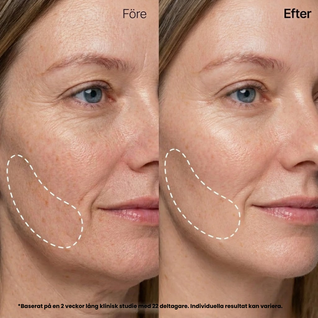 Silk Peptide Gold Mask