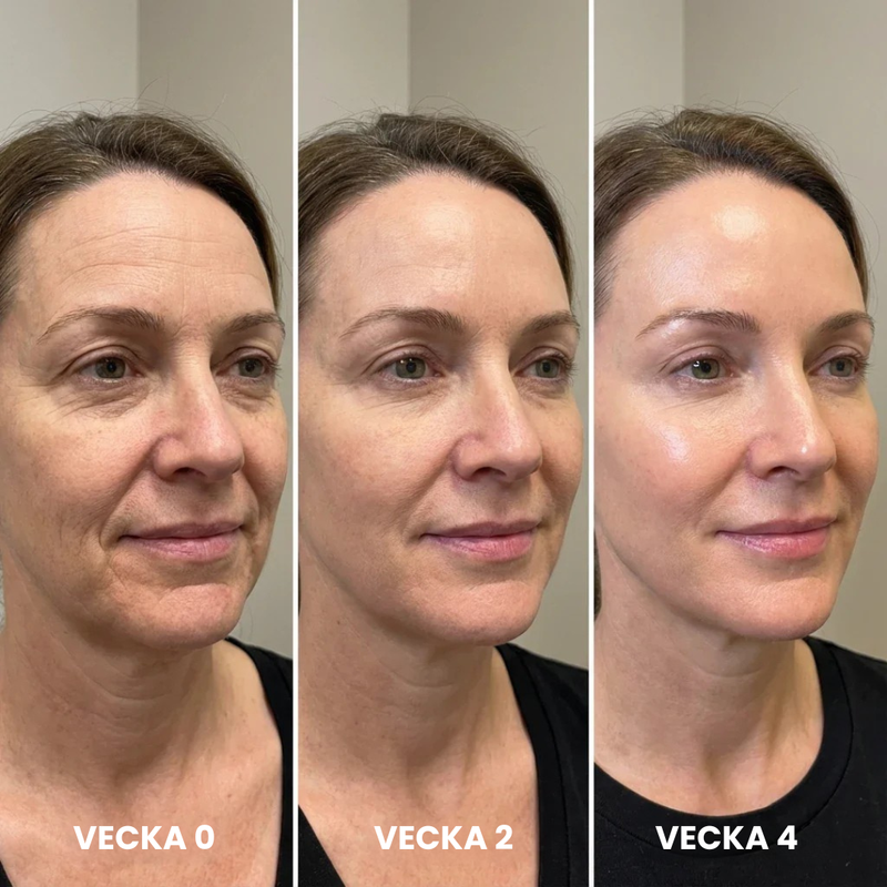 Anledning #4: Transformationstidslinjen — Vad Du Kan Förvänta Dig Vecka För Vecka